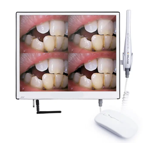 Intra oral camera RA300